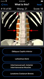 anatomy spine quiz iphone screenshot 2