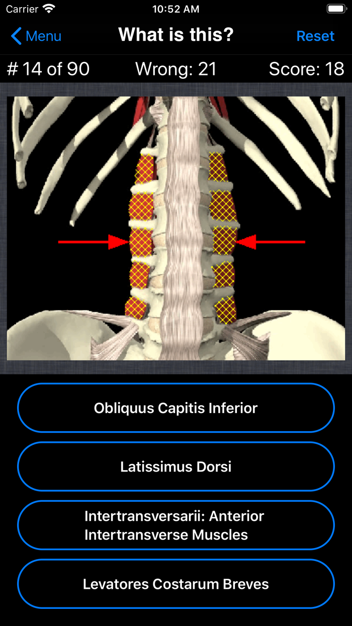 Anatomy Spine Quiz