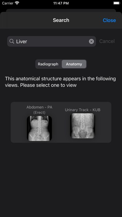 Xray Anatomy Screenshot