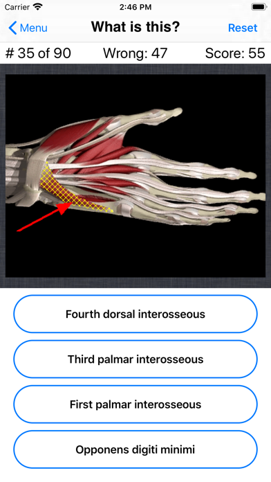 Anatomy Hand Quizのおすすめ画像5