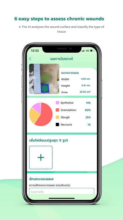 WoundSee screenshot-5