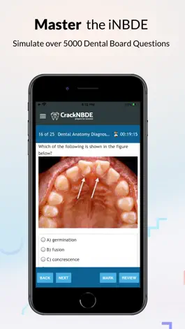 Game screenshot Crack iNBDE Dental Boards Prep apk