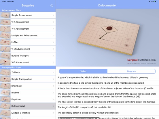 Screenshot #5 pour Surgical Flaps