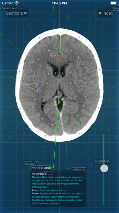 X-Anatomy Proのおすすめ画像8