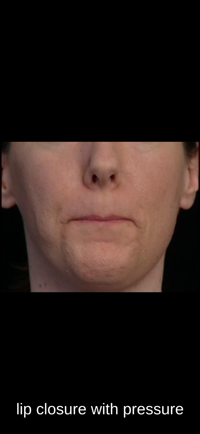 SmallTalk Oral Motor Exercises