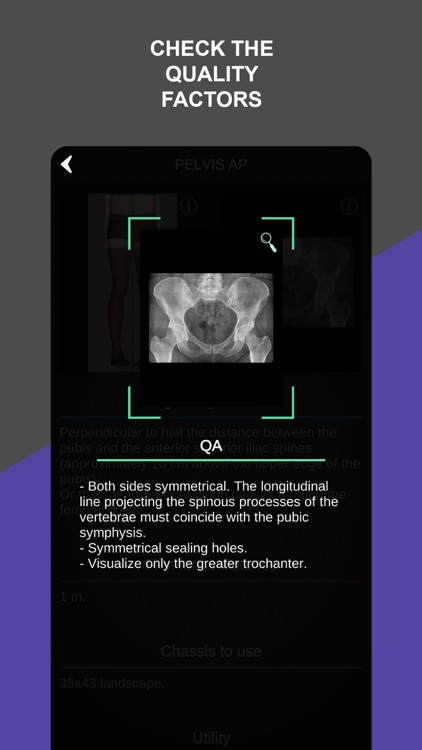 RX - Radiographic Positioning screenshot-6