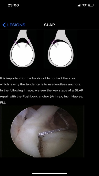 iShoulder screenshot-5