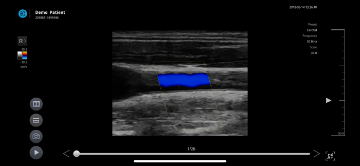 SONON X Ultrasound App US - KR
