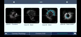 Game screenshot IVUS + Physiology Pro apk