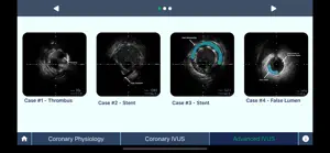 IVUS + Physiology Pro screenshot #2 for iPhone