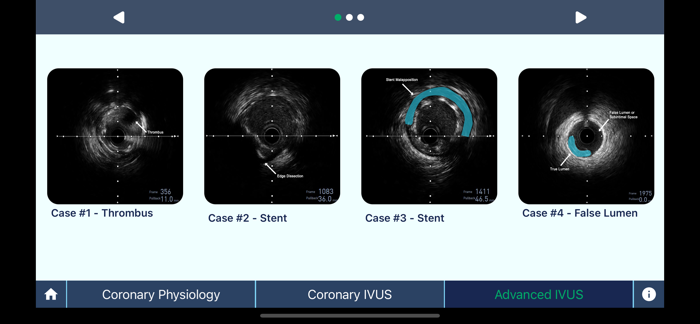 IVUS  Physiology Pro