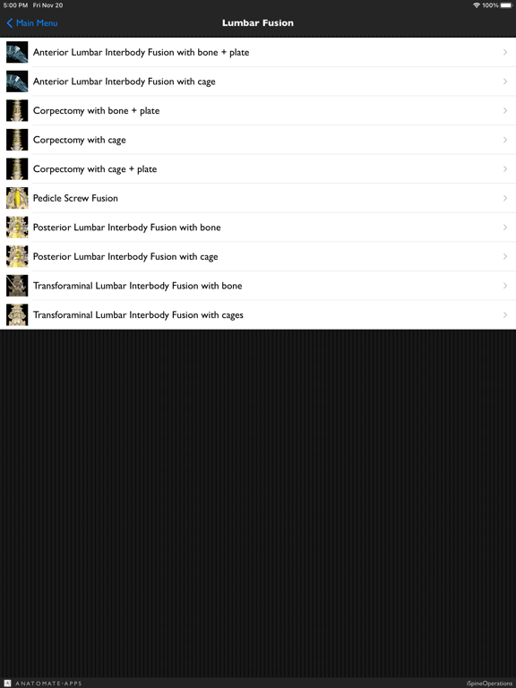 Screenshot #5 pour iSpineOperations