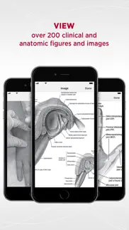 5 minute sports med consult iphone screenshot 2