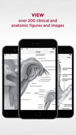 Game screenshot 5 Minute Sports Med Consult apk