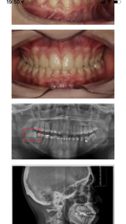 Ortodoncia Mercedes Fayos