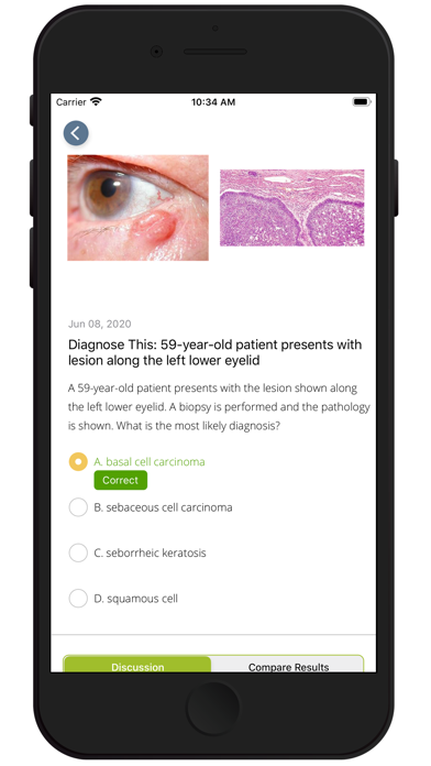 AAO Ophthalmic Education Screenshot