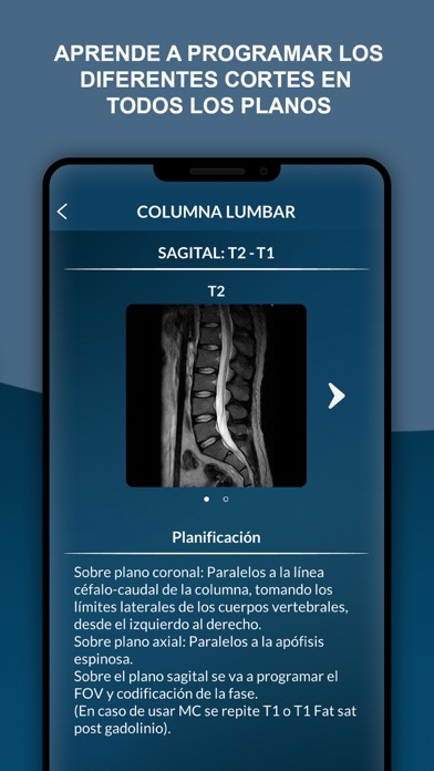 MRI - Protocolos de Resonanciaのおすすめ画像5