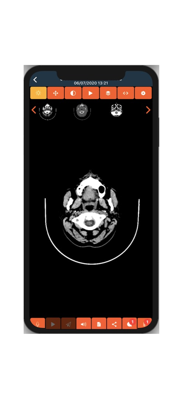 STAR Telerradiologia