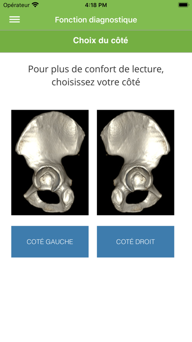 Screenshot #3 pour Acetabular Fractures