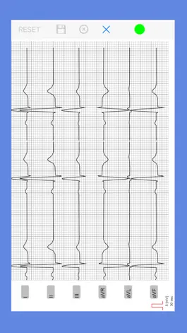 Game screenshot AIS ECG App mod apk