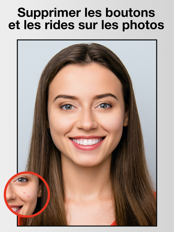 Screenshot #4 pour Pimple & Wrinkle Eraser