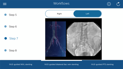 Philips Venous IVUS Tutor Screenshot