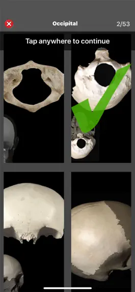 Game screenshot Anatomy Quiz Pro apk