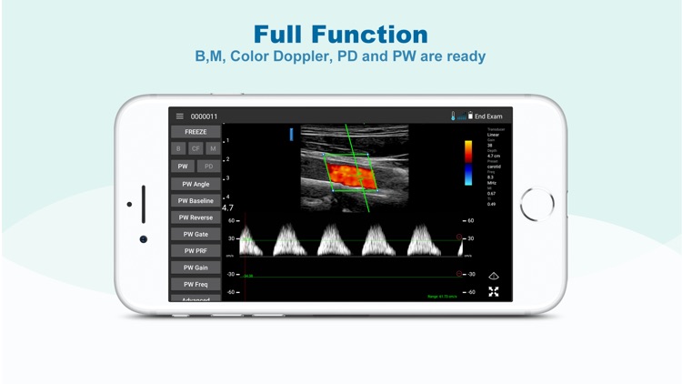 uREzpocus