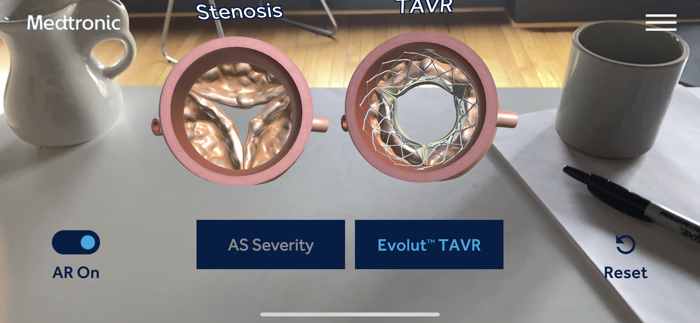 AS TAVR Education