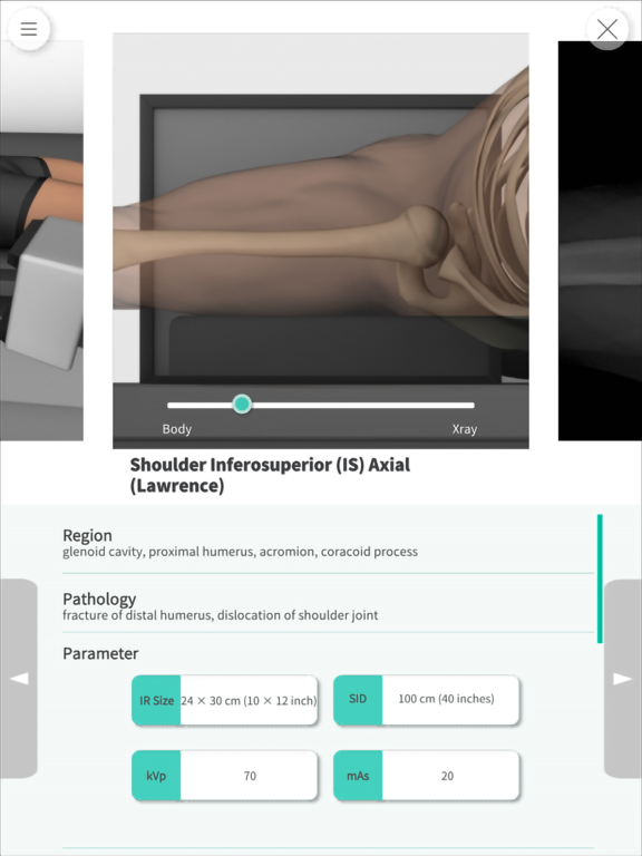 Navi Radiography Proのおすすめ画像5