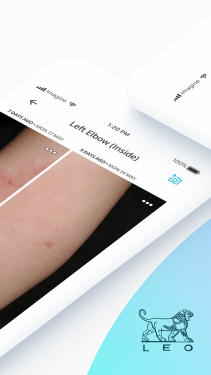 Imagine – Skin Tracker