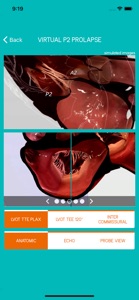 Mitral View screenshot #5 for iPhone