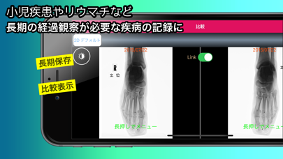 MedalVision Personal Med Image Screenshot