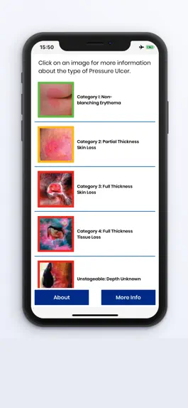 Game screenshot BCG Pressure Ulcer Guide hack