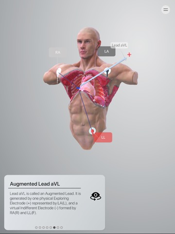 3D ECG Leadsのおすすめ画像7