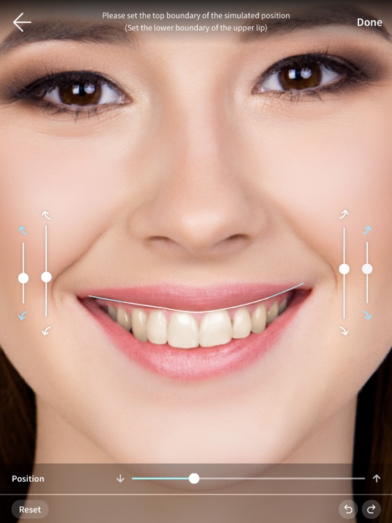 QuicSmile Pro