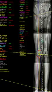 osteotomyapp problems & solutions and troubleshooting guide - 1