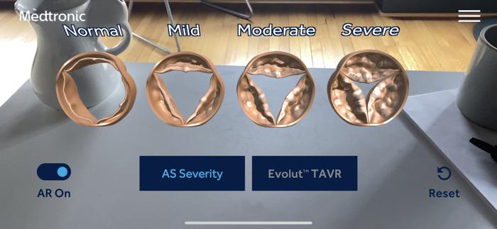 AS TAVR Education