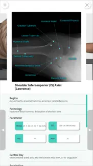 navi radiography lite problems & solutions and troubleshooting guide - 4