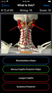 anatomy spine quiz iphone screenshot 4