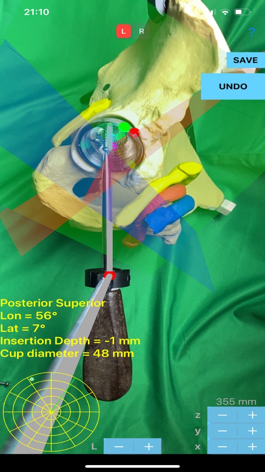 #4. ScrewCupNaviAR (iOS) 由: ORTHOPRACTIS.COM SINGLE MEMBER P.C.
