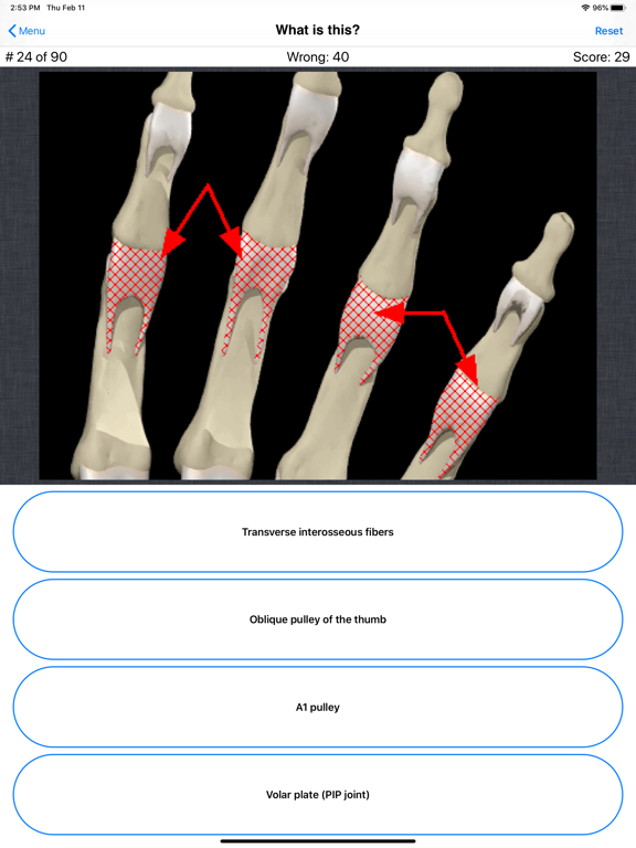 Anatomy Hand Quizのおすすめ画像6