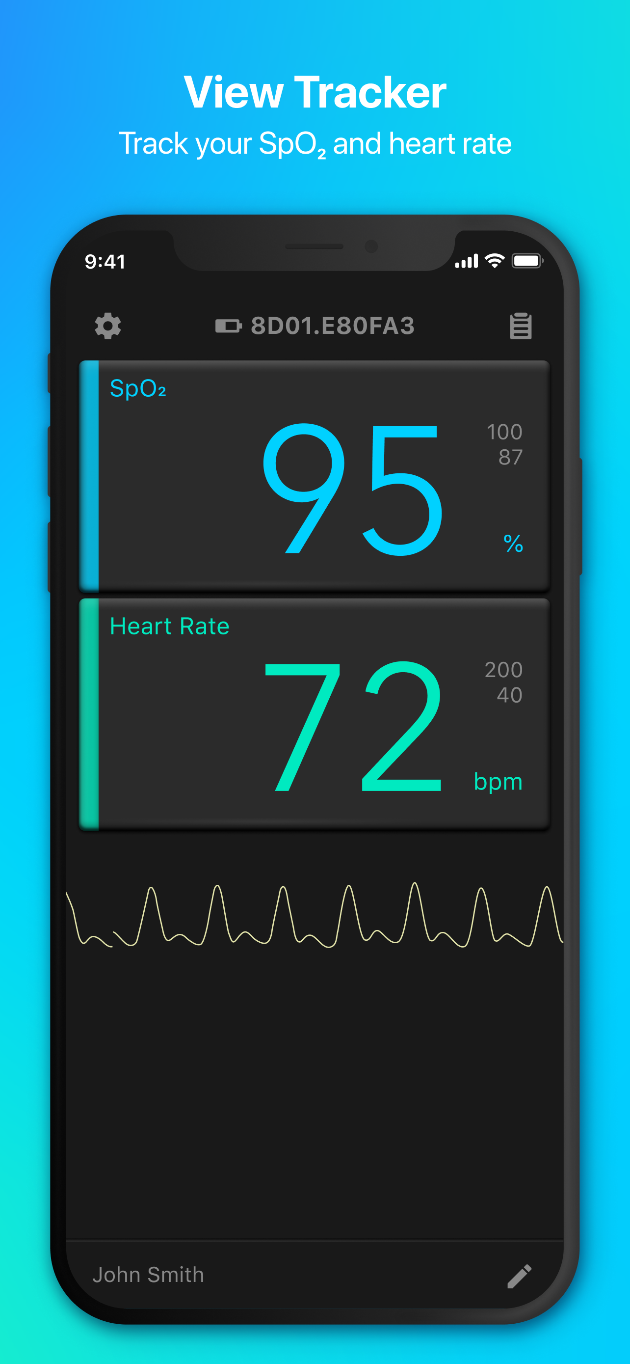 View Tracker SpO2 & Pulse rate