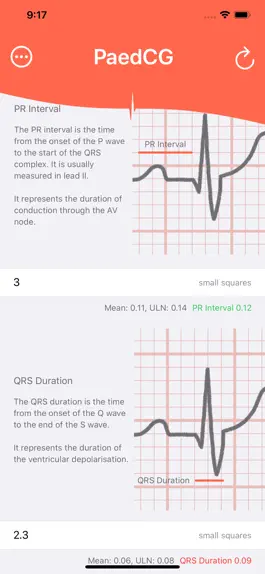 Game screenshot PaedCG - Paediatric ECG apk