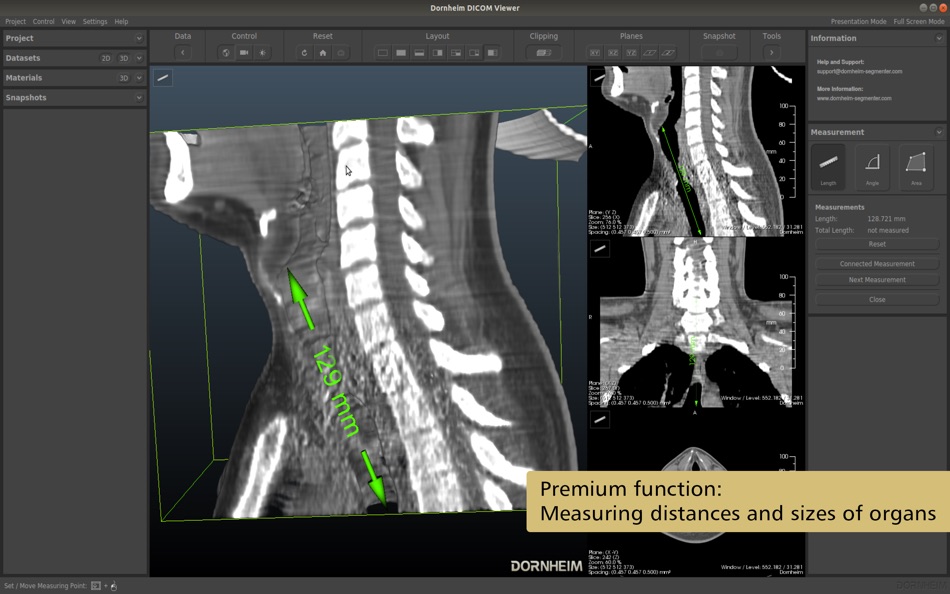 #4. Dornheim Viewer (macOS) By: Dornheim Medical Images GmbH