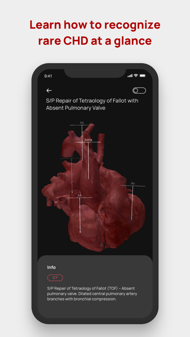Congenital heARts Screenshot