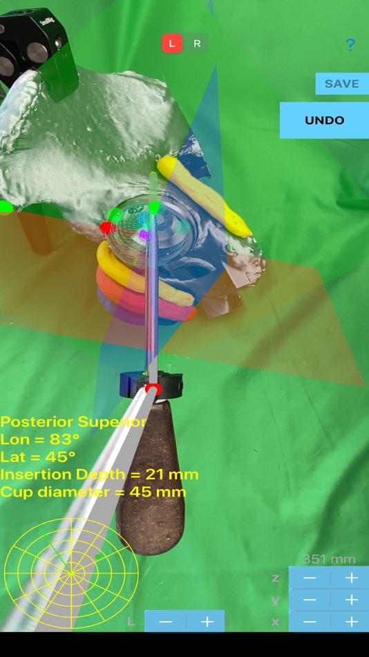 #8. ScrewCupNaviAR (iOS) 由: ORTHOPRACTIS.COM SINGLE MEMBER P.C.