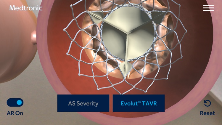 AS TAVR Education screenshot-4