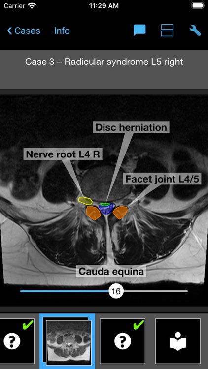 BerlinCaseViewer: Imaging