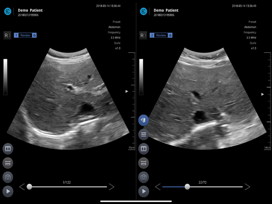 SONON X Ultrasound App US / KR iPad screenshot 4 - Medical app